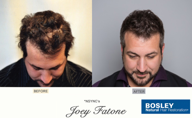 N Sync Joey Fatone Bosley Hair Loss Spokesperson Ad